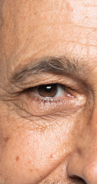 Ícone Blefaroplastia