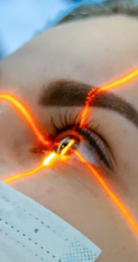 Imagem Refrativa