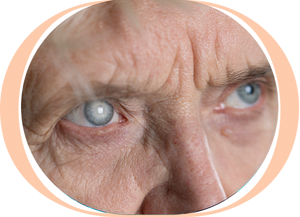 Imagem Cirurgia Refrativa